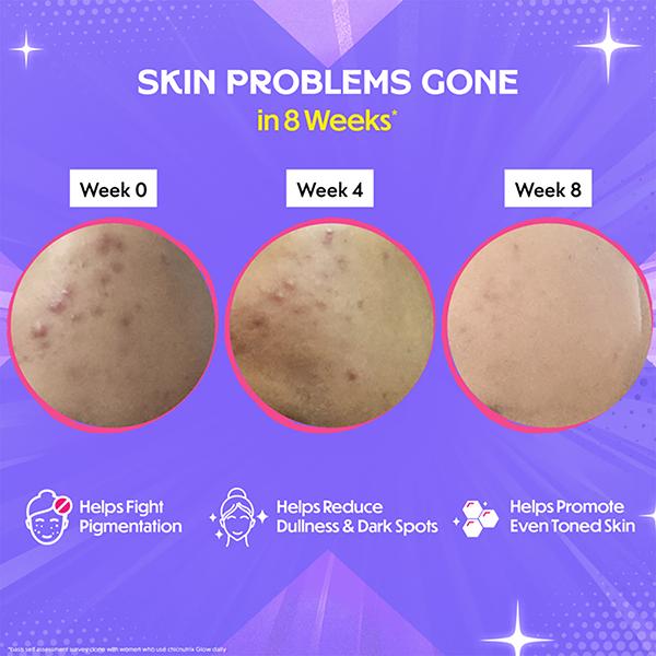 glutathione tablet before and after results Chicnutrix Glow - & Vitamin C Tablets 20's for Skin Radiance - Strawberry & Lemon Flavour We've got two new Pack Size:100 ml ميديكيوب جلوتاثيون جلو سيروم